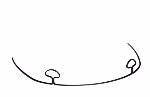 Beta-T Mushroom Loop Retraction Arch